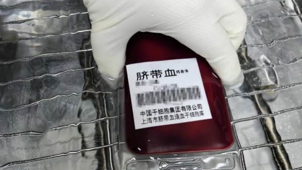 小宝脐血救大宝，上海脐血库联合苏州儿童医院完成救治