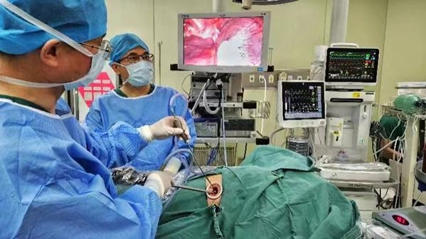 “动脉归属法”新技术让早期肺癌手术不再“一刀切”