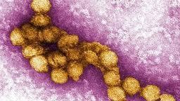 以色列已有81人感染西尼罗河病毒 7人死亡