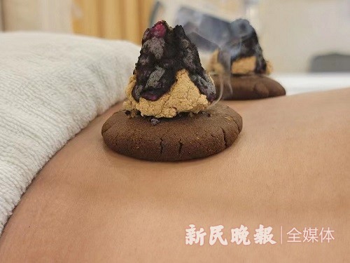 中药热奄包怎么蒸康健园 ｜ 尿频起夜别烦恼 中医灸敷除困扰_https://www.jmylbn.com_新闻资讯_第3张