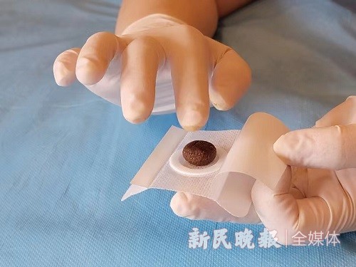 中药热奄包怎么蒸康健园 ｜ 尿频起夜别烦恼 中医灸敷除困扰_https://www.jmylbn.com_新闻资讯_第2张